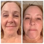 before_after_41