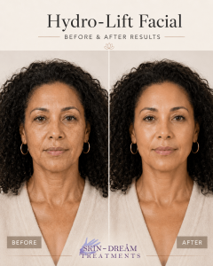 BEFORE & AFTER HYDRO GLOW (3) (1)